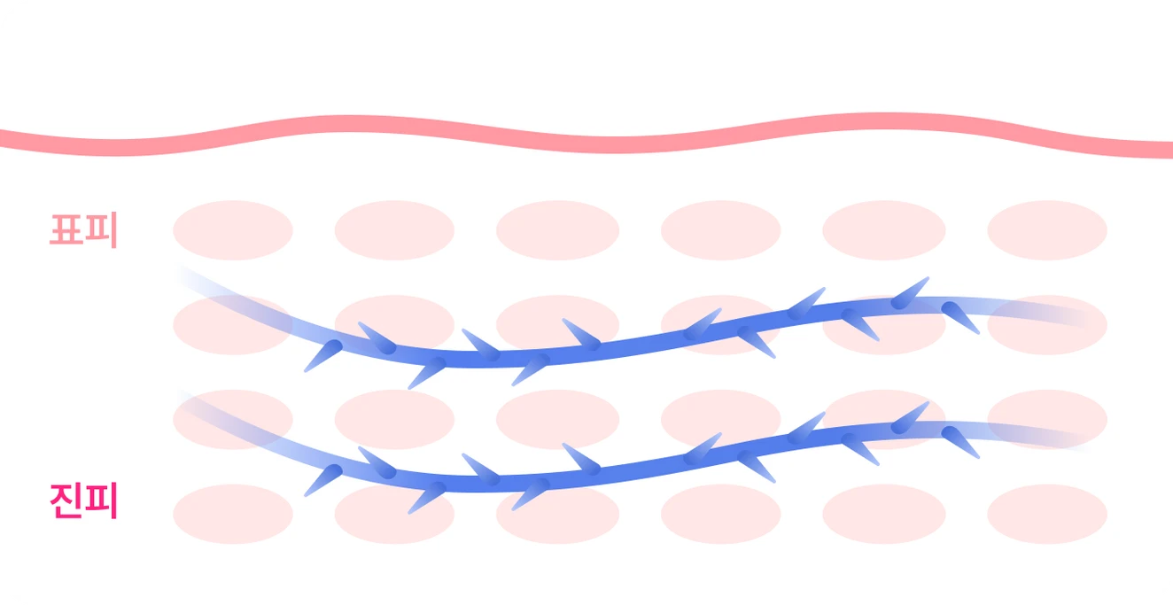 Concertina-1
